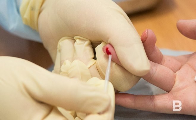 HIV incidence decreases in Tatarstan, but number of tests also falls