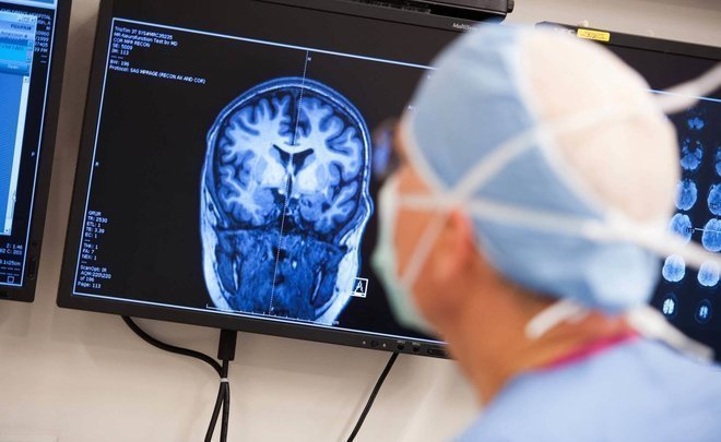 Myths and truth about epilepsy